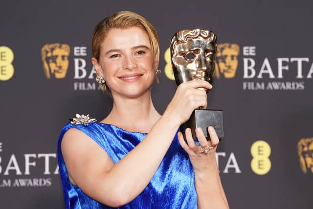 Buckley described acting as “essential” and said it is “like water to me”, adding that her passion for her craft helped her to overcome an eating disorder and depression during her school years.