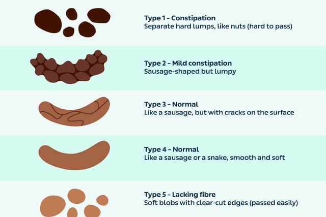 The symptoms of IBS-C include abdominal pain and discomfort, along with changes in bowel function. Bloating and/or gas also may happen. Changes in bowel function may include straining, infrequent stools, hard or lumpy stools, and/or a feeling that the bowel does not empty completely. Some people may feel as if there is a “blockage” preventing them from passing stools. They may need to press on a part of their body or change body position to help them complete their bowel movement. How often a person passes stool, or the way it appears, may be different when abdominal discomfort is happening. With IBS-C, abdominal discomfort often improves after a bowel movement. In most cases, symptoms are ongoing (chronic), but they may come and go.