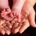 Baby born with DNA from three people