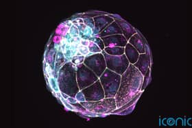 The research could help increase the understanding of the early stages of human development and to develop therapeutics for infertility or contraceptives.