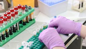 Public Health Mid-West is raising awareness of meningococcal disease following a death in Limerick