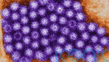 Norovirus cases up over 50% in a week &ndash; HSE