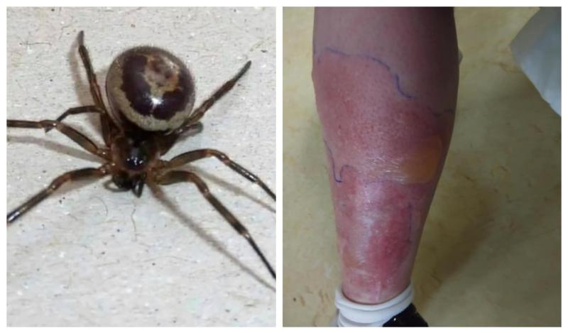ALERT: Deadly false widow spiders  more likely to invade Offaly homes as weather changes 