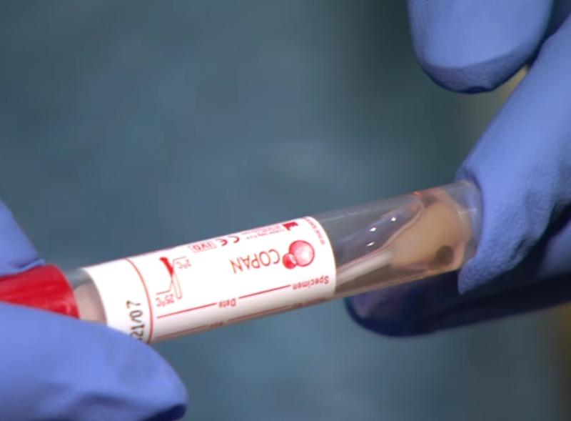 Possible projections on hospital admissions during Covid-19 surge expected 