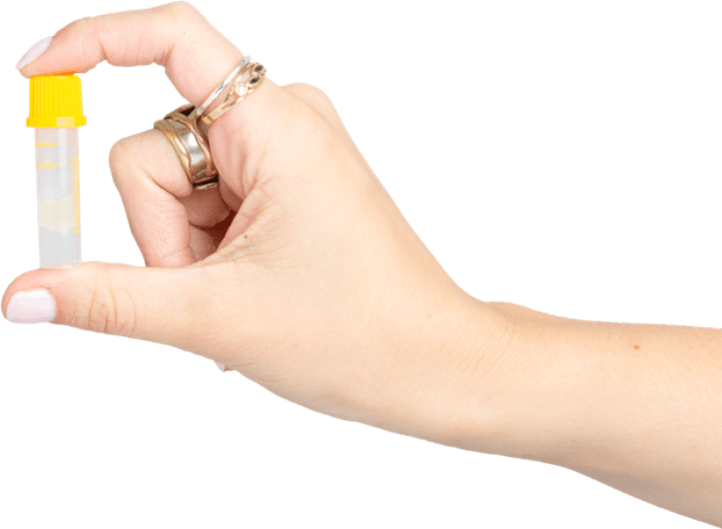 Free home STI testing programme expanded to Tipperary