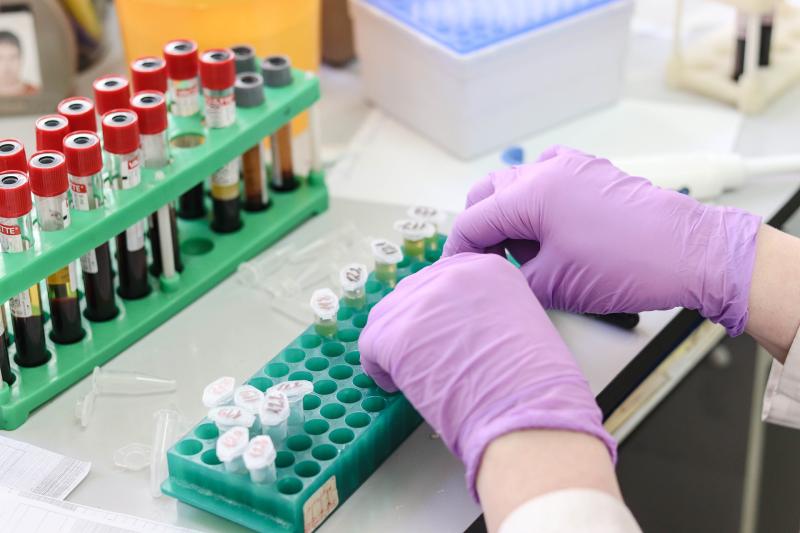 Public Health Mid-West are investigating possible cases of meningococcal disease 