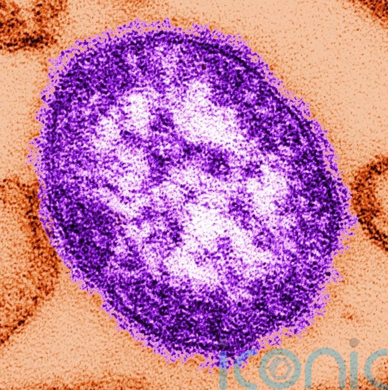 Nine suspected cases of measles in Ireland recorded in one week