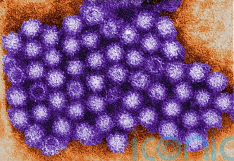 Norovirus cases up over 50% in a week &ndash; HSE